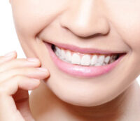 story_1_after-200×173